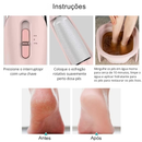 Lixador Elétrico para Pés – Removedor de Calos e Pele Morta com Lixa Rotativa